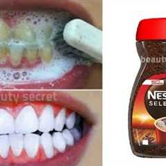 Teeth whitening in 1 minute/ removing the yellowness and tartar accumulated in the teeth,💯..