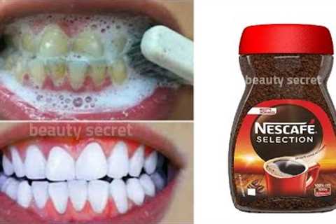 Teeth whitening in 1 minute/ removing the yellowness and tartar accumulated in the teeth,💯..